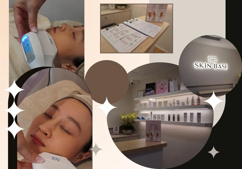 Skin Base 8D Hifu Review Featured Image