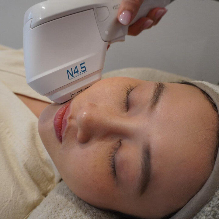 Skin Base 8D Hifu Treatment no hard sell transparent pricing