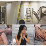 BMF Fotona Laser Tightening Featured Image