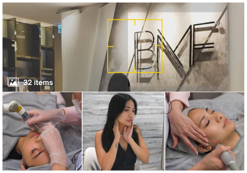 BMF Fotona Laser Tightening Featured Image