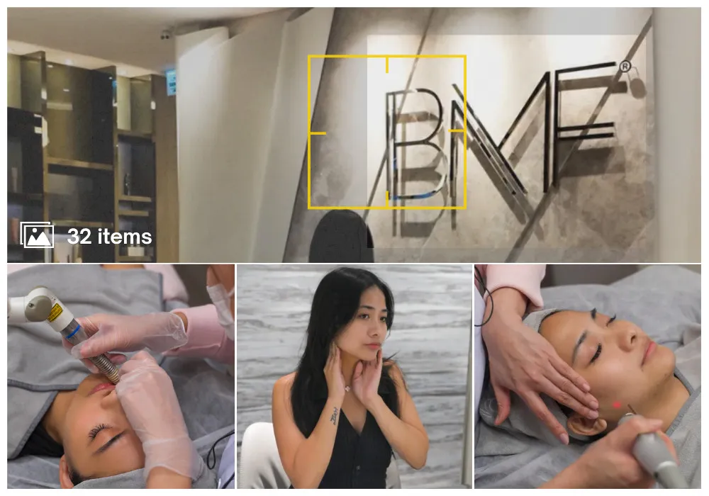 BMF Fotona Laser Tightening Featured Image