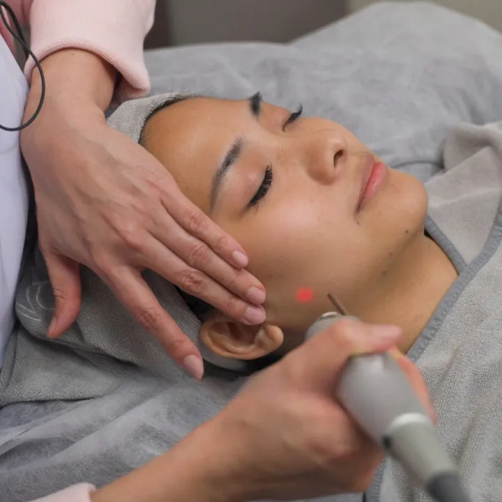 BMF Fotona Laser Tightening collagen